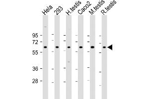 All lanes : Anti-SLC2A8 Antibody (Center) at 1:2000 dilution Lane 1: Hela whole cell lysate Lane 2: 293 whole cell lysate Lane 3: human testis lysate Lane 4: Caco2 whole cell lysate Lane 5: mouse testis lysate Lane 6: rat testis lysate Lysates/proteins at 20 μg per lane. (SLC2A8 Antikörper  (AA 260-292))