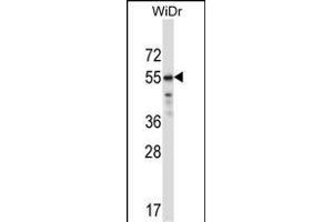 TFCP2L1 Antibody (Center) (ABIN657290 and ABIN2846376) western blot analysis in WiDr cell line lysates (35 μg/lane).