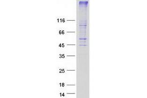 Western Blotting (WB) image for G Protein-Coupled Receptor 171 (GPR171) protein (Myc-DYKDDDDK Tag) (ABIN2722188)