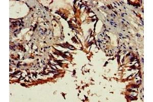Immunohistochemistry of paraffin-embedded human lung tissue using ABIN7149671 at dilution of 1:100