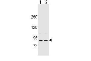 Western Blotting (WB) image for anti-Periostin (POSTN) antibody (ABIN2996464) (Periostin Antikörper)