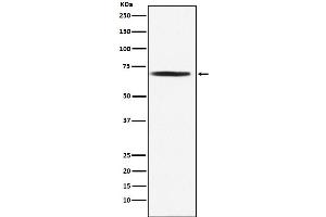 Western Blotting (WB) image for anti-Dihydrolipoyl Transacetylase (DLAT) antibody (ABIN7606798)