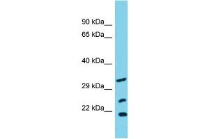 Host: Rabbit Target Name: SLC25A17 Sample Type: OVCAR-3 Whole Cell lysates Antibody Dilution: 1. (SLC25A17 Antikörper  (N-Term))