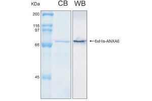 10% SDS-PAGE stained with Coomassie Blue (CB), immunobloting with anti-6xHis (WB) serum and peptide fingerprinting by MALDI-TOF-TOF mass spectrometry (ANXA6 Protein (AA 1-673) (His tag))
