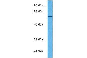 Host:  Rabbit  Target Name:  EYA1  Sample Tissue:  Human ACHN Whole Cell  Antibody Dilution:  1ug/ml (EYA1 Antikörper  (Middle Region))