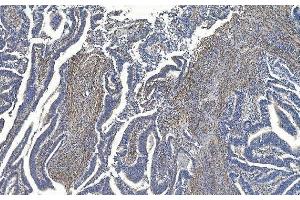 IHC analysis of Filamin A/FLNA using anti-Filamin A/FLNA antibody (ABIN7601783).