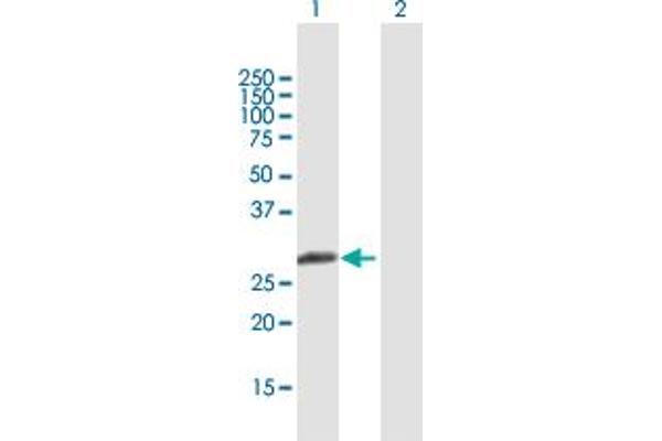 MBNL3 anticorps  (AA 1-258)