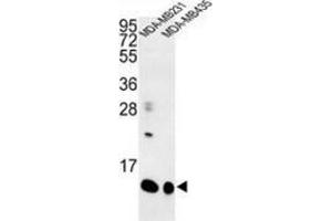 Western blot analysis of Cornifin-B (arrow) in MDA-MB231, MDA-MB435 cell line lysates (35ug/lane) using SPRR1B / Cornifin-B Antibody (C-term).