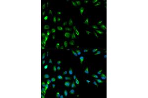Immunofluorescence analysis of HeLa cells using RASSF1 antibody. (RASSF1 Antikörper)