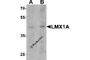 Western Blotting (WB) image for anti-LIM Homeobox Transcription Factor 1, alpha (LMX1A) (C-Term) antibody (ABIN1077395)