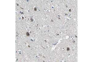 Immunohistochemical staining of human cerebral cortex with SLC16A7 polyclonal antibody  shows moderate cytoplasmic positivity in neuronal cells. (SLC16A7 Antikörper)