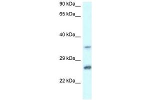 Western Blot showing CBR4 antibody used at a concentration of 1 ug/ml against Jurkat Cell Lysate (CBR4 Antikörper  (C-Term))