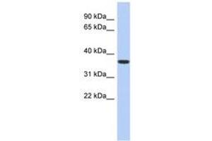 Image no. 1 for anti-Mevalonate Kinase (MVK) (AA 107-156) antibody (ABIN6743974) (MVK Antikörper  (AA 107-156))