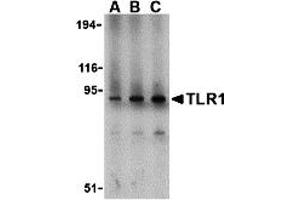 Western Blotting (WB) image for anti-Toll-Like Receptor 1 (TLR1) (N-Term) antibody (ABIN1031619) (TLR1 Antikörper  (N-Term))