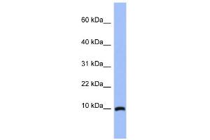 WB Suggested Anti-ACBD7 Antibody Titration: 0.