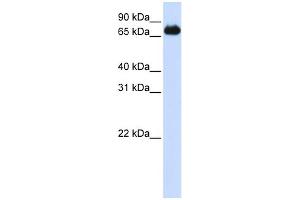 WB Suggested Anti-FOXK2 Antibody Titration:  0. (Forkhead Box K2 Antikörper  (Middle Region))