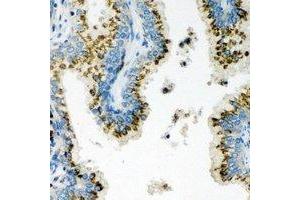 Immunohistochemical analysis of Unc18-2 staining in human prostate formalin fixed paraffin embedded tissue section. (STXBP2 Antikörper)