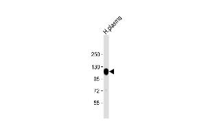 Anti-ITIH4 Antibody (C-Term) at 1:2000 dilution + human plasma lysate Lysates/proteins at 20 μg per lane. (ITIH4 Antikörper  (AA 885-917))