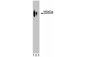Western blot analysis of delta-Catenin on rat brain lysate. (CTNND2 Antikörper  (AA 85-194))