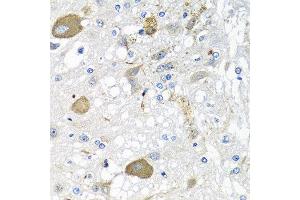 Immunohistochemistry of paraffin-embedded rat brain using IFNL3 antibody at dilution of 1:100 (40x lens). (IL28B Antikörper)