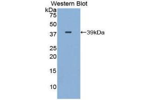 Western Blotting (WB) image for anti-gamma Lipotropin (AA 179-234) antibody (ABIN1859027) (gamma Lipotropin (AA 179-234) Antikörper)