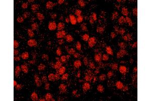 Immunofluorescence (IF) image for anti-REST Corepressor 3 (RCOR3) (AA 445-495) antibody (ABIN7449047) (RCOR3 Antikörper  (AA 445-495))