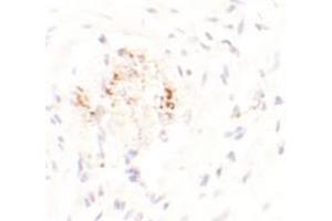 Immunohistochemical analysis of LEMD3 in human colon tissue with LEMD3 polyclonal antibody  at 2.
