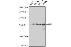 Western blot analysis of extracts of various cell lines, using TTF2 antibody. (TTF2 Antikörper  (AA 1-270))