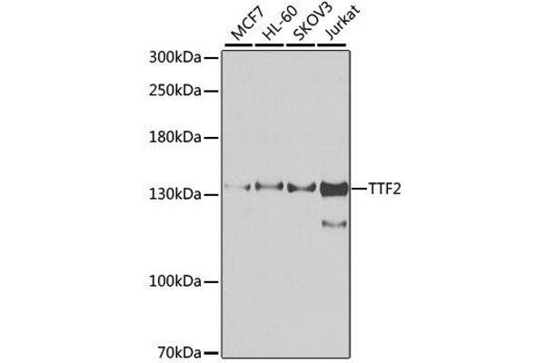 TTF2 Antikörper  (AA 1-270)