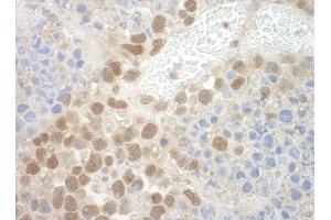 Immunohistochemistry (IHC) image for anti-Pogo Transposable Element with ZNF Domain (POGZ) (AA 1360-1410) antibody (ABIN7448730) (POGZ Antikörper  (AA 1360-1410))