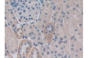 Detection of CENTa2 in Rat Kidney Tissue using Polyclonal Antibody to Centaurin Alpha 2 (CENTa2) (ADAP2 Antikörper  (AA 49-360))