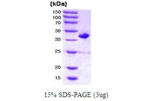 SDS-PAGE (SDS) image for Ras-Related C3 Botulinum Toxin Substrate 2 (Rho Family, Small GTP Binding Protein Rac2) (RAC2) (AA 1-192) protein (GST tag) (ABIN667712) (RAC2 Protein (AA 1-192) (GST tag))