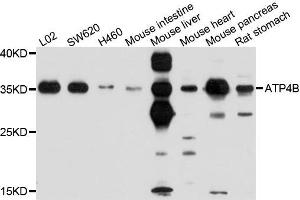 Western blot analysis of extracts of various cells, using ATP4B antibody. (ATP4b Antikörper)