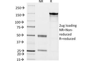 SDS-PAGE (SDS) image for anti-CD14 (CD14) (AA 25-148), (Extracellular Domain) antibody (ABIN6383875)