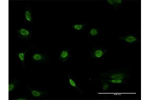 Immunofluorescence of monoclonal antibody to PAX8 on HeLa cell. (PAX8 Antikörper  (AA 141-250))