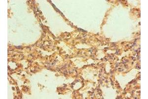 Immunohistochemistry of paraffin-embedded human lung tissue using ABIN7146530 at dilution of 1:100 (CAPNL1 Antikörper  (Catalytic Subunit))