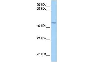 WB Suggested Anti-LRRFIP2 Antibody Titration: 1. (LRRFIP2 Antikörper  (N-Term))