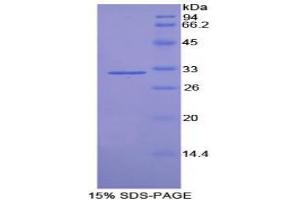 SDS-PAGE analysis of Rat Tubulin delta Protein. (TUBD1 Protein)