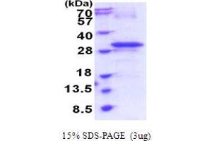 SDS-PAGE (SDS) image for Receptor (Chemosensory) Transporter Protein 4 (RTP4) (AA 1-224) protein (His tag) (ABIN5854002)
