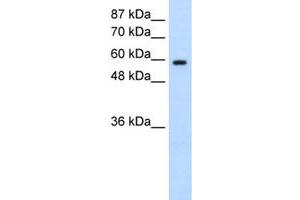 Western Blot analysis of Daudi cell lysate with DAZ2 polyclonal antibody  at 0. (DAZ2 Antikörper  (N-Term))