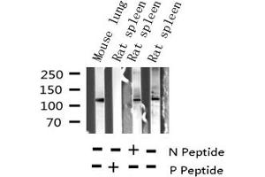 Western blot analysis of Phospho-JAK2 (Tyr221) expression in various lysates (JAK2 Antikörper  (pTyr221))