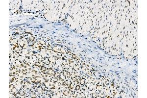 Phospho-BRG1 (Ser721) Antibody at 1/100 staining Rat stomach tissue by IHC-P.