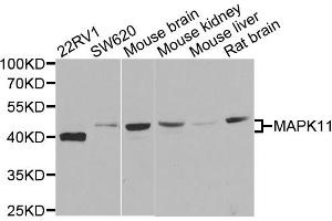 Western blot analysis of extracts of various cell lines, using MAPK11 antibody (ABIN5995380) at 1/500 dilution.