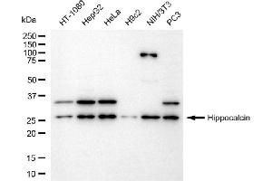 Western blotting analysis using hippocalcin antibody (ABIN7798912). (Rekombinanter Hippocalcin Antikörper)
