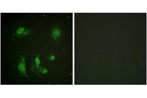 Immunofluorescence analysis of HeLa cells, using Survivin (Ab-117) Antibody. (Survivin Antikörper  (AA 86-135))