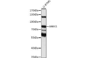 Western blot analysis of extracts of U-87MG cells, using  antibody (ABIN7265605) at 1:1000 dilution. (ANKK1 Antikörper  (AA 1-300))