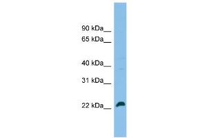 WB Suggested Anti-SPATA24 Antibody Titration: 0. (SPATA24 Antikörper  (C-Term))
