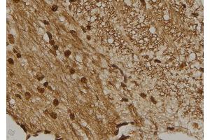 ABIN6273461 at 1/100 staining Mouse brain tissue by IHC-P. (CENPM Antikörper  (Internal Region))