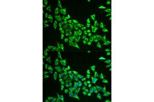 Immunofluorescence analysis of HeLa cell using MRPS30 antibody. (MRPS30 Antikörper)