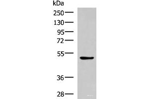 Western blot analysis of LOVO cell lysate using BLNK Polyclonal Antibody at dilution of 1:600 (B-Cell Linker Antikörper)